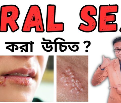 Alarm: Oral Sex in Festive Seasons, what Rwandans Must Know About Hidden Risks